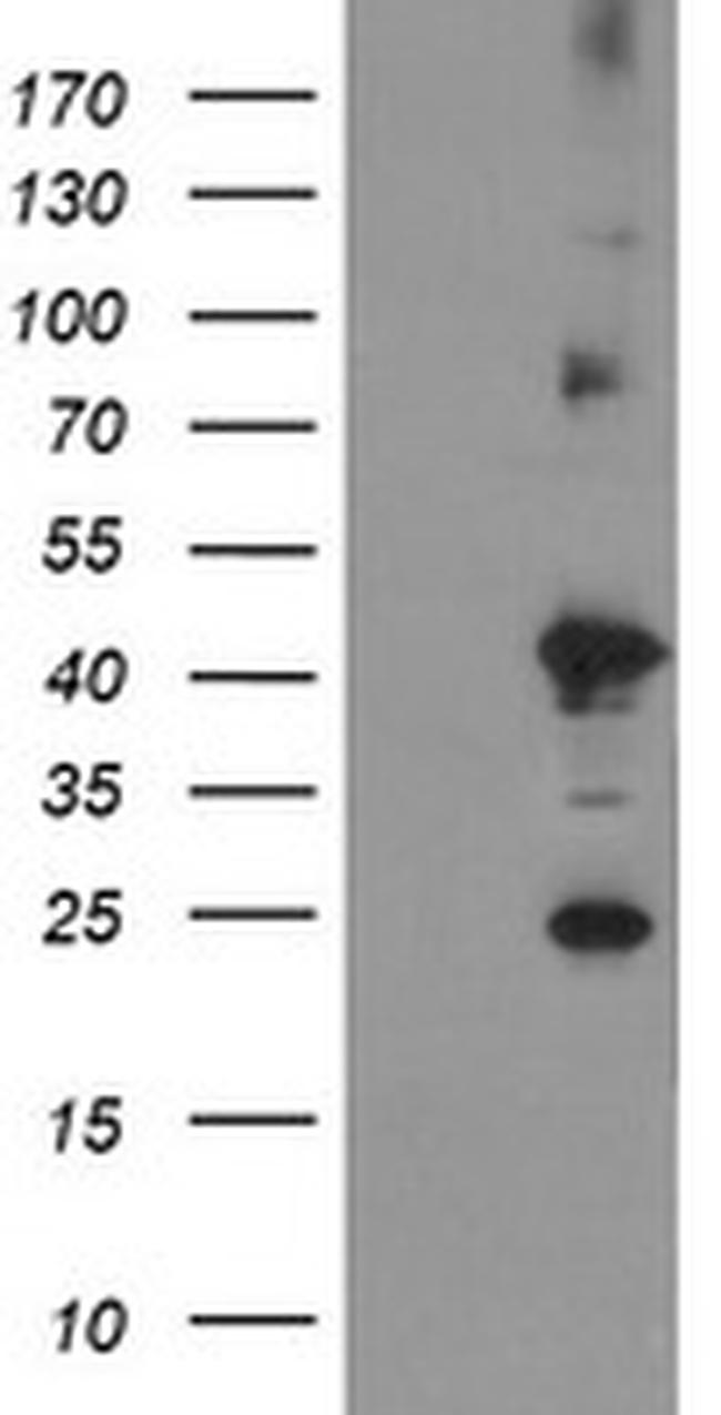 TMEM173 Antibody in Western Blot (WB)