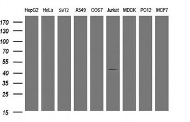 TMEM173 Antibody in Western Blot (WB)