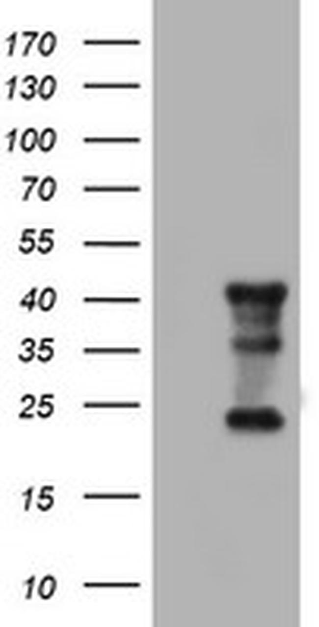 TMEM173 Antibody in Western Blot (WB)