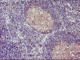 TMOD1 Antibody in Immunohistochemistry (Paraffin) (IHC (P))