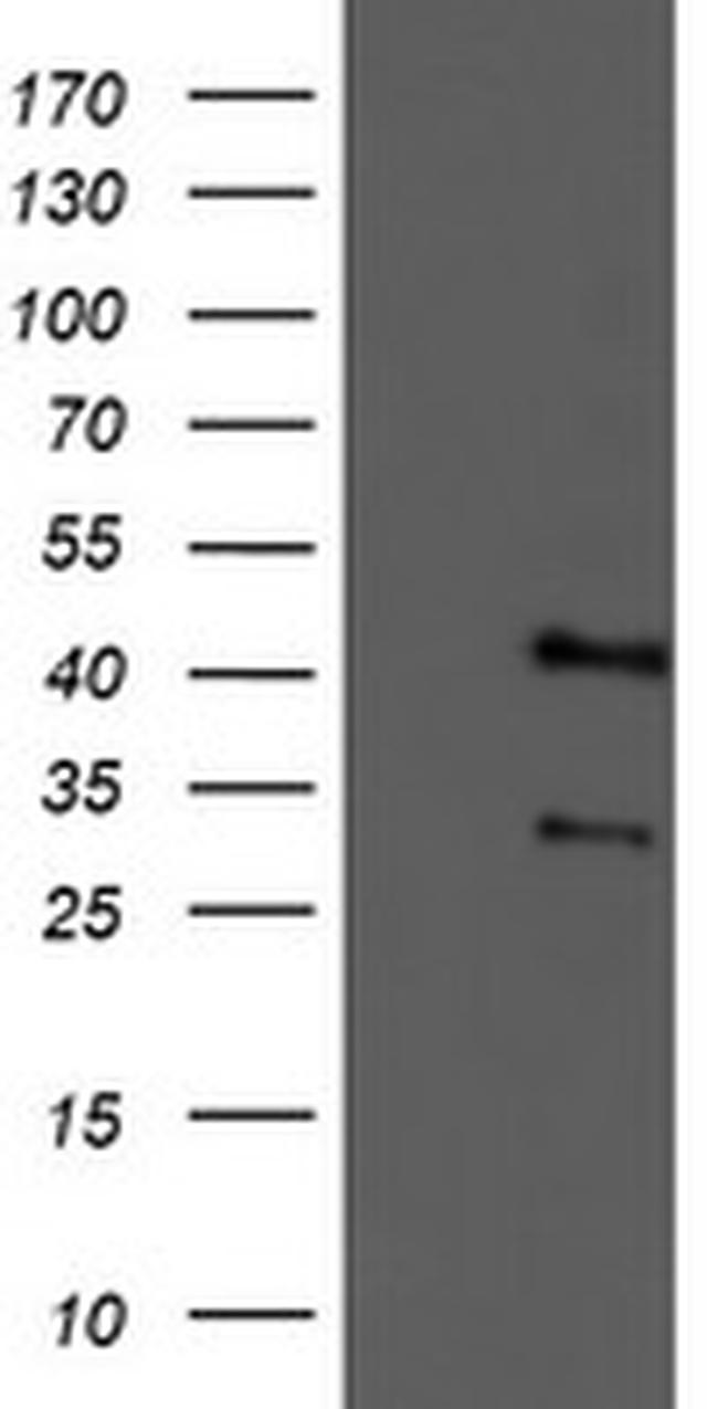 TMOD1 Antibody in Western Blot (WB)