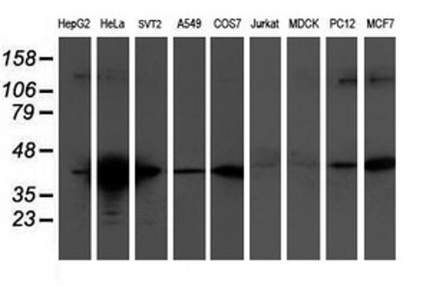 TMOD1 Antibody in Western Blot (WB)