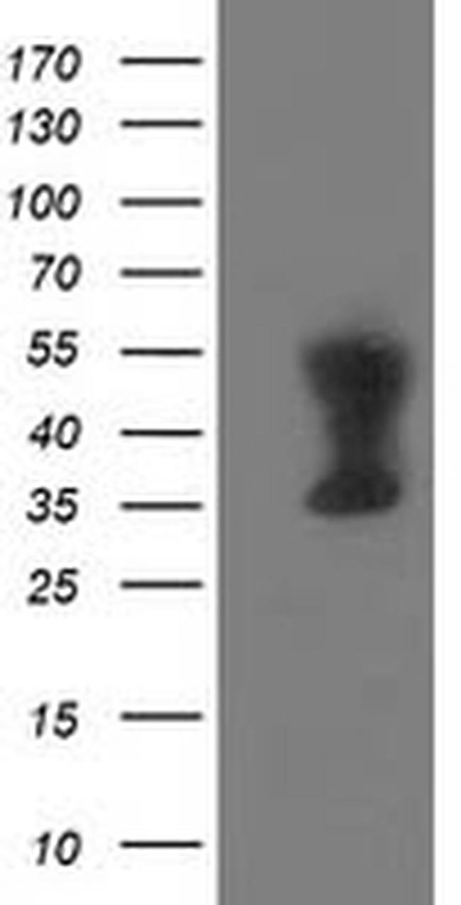 TMOD1 Antibody in Western Blot (WB)