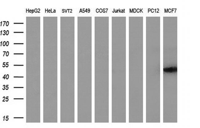 TMOD1 Antibody in Western Blot (WB)