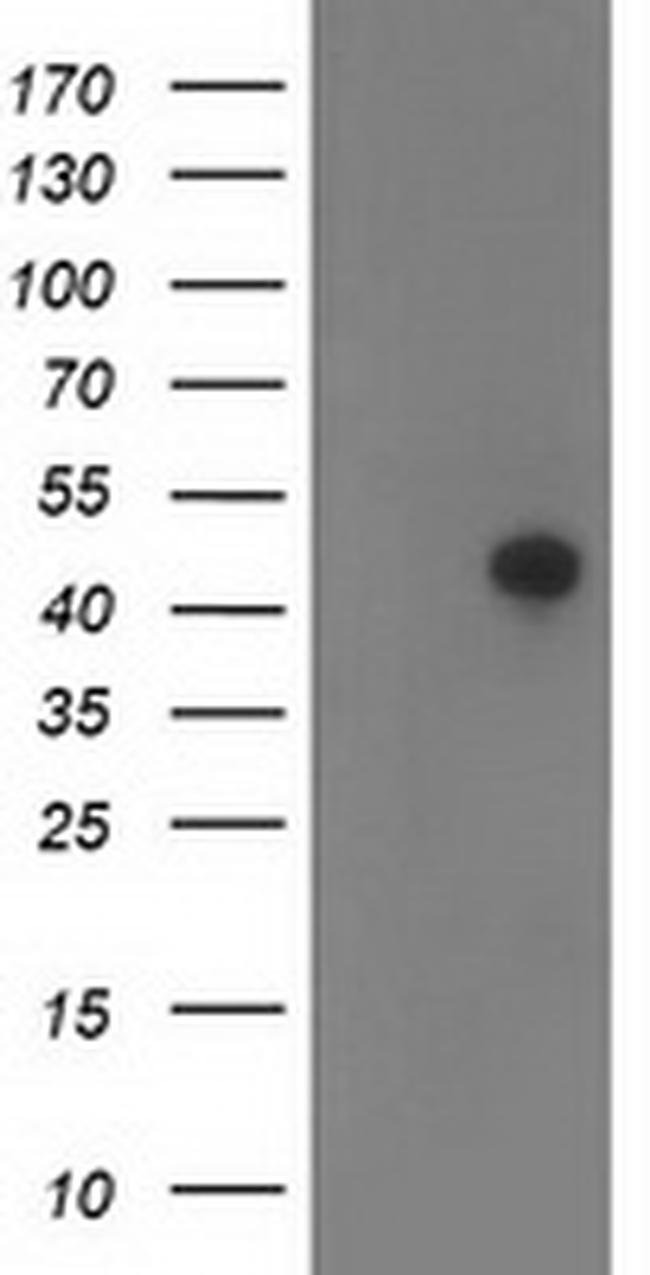 TMOD1 Antibody in Western Blot (WB)