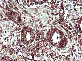 TMX1 Antibody in Immunohistochemistry (Paraffin) (IHC (P))