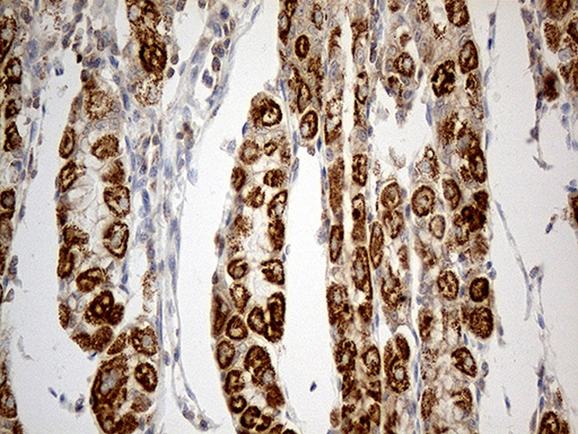 TNFAIP8 Antibody in Immunohistochemistry (Paraffin) (IHC (P))