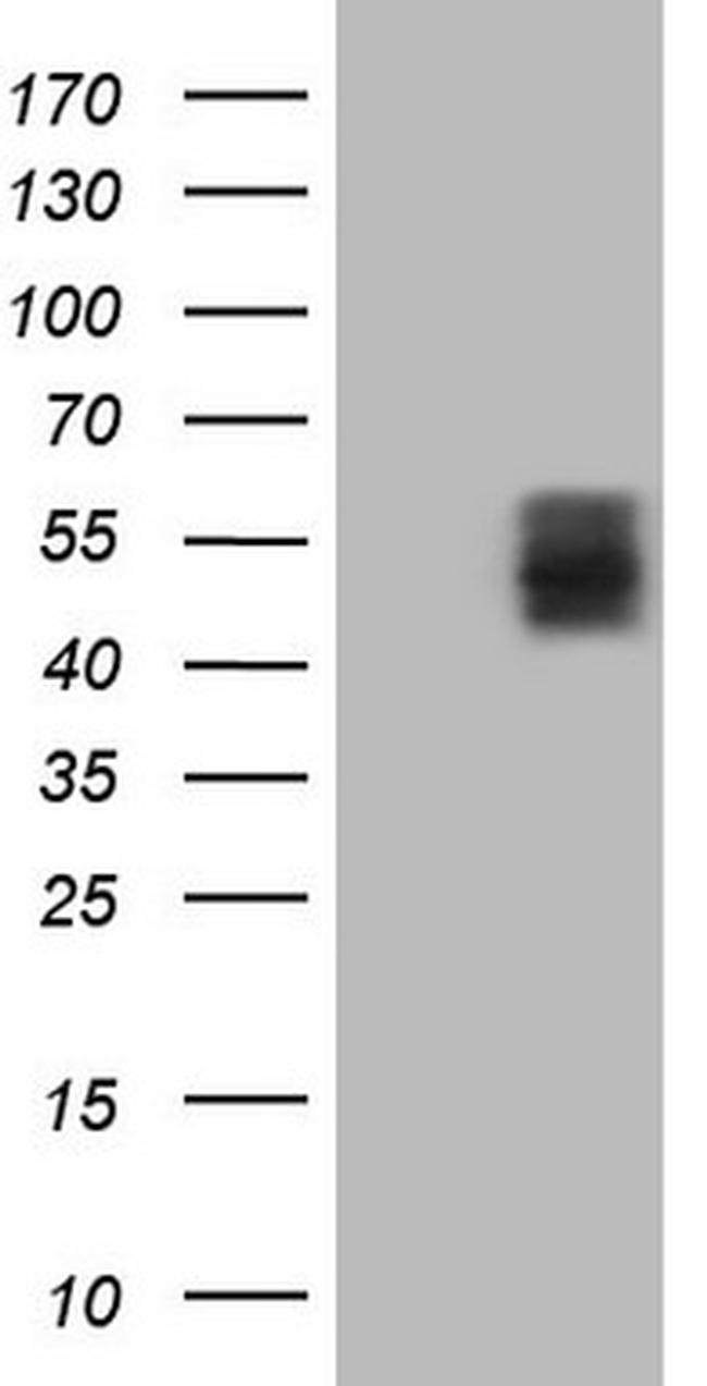 TNFRSF10A Antibody in Western Blot (WB)