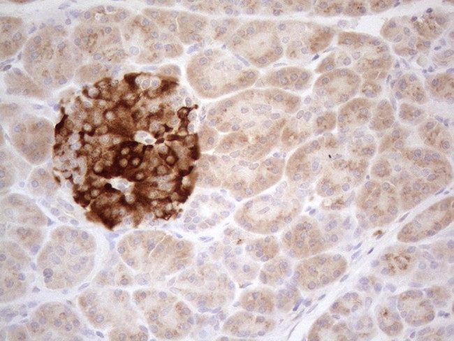 TNFRSF10B Antibody in Immunohistochemistry (Paraffin) (IHC (P))