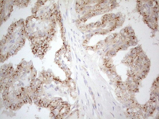 TNFRSF10B Antibody in Immunohistochemistry (Paraffin) (IHC (P))