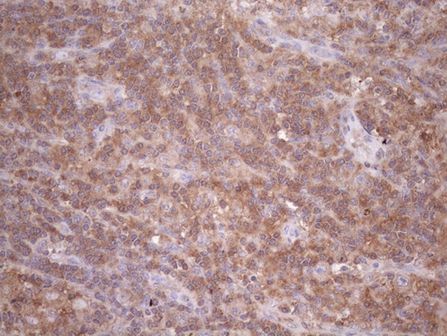 TNFRSF10B Antibody in Immunohistochemistry (Paraffin) (IHC (P))