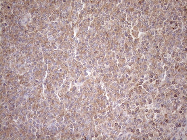 TNFRSF10B Antibody in Immunohistochemistry (Paraffin) (IHC (P))