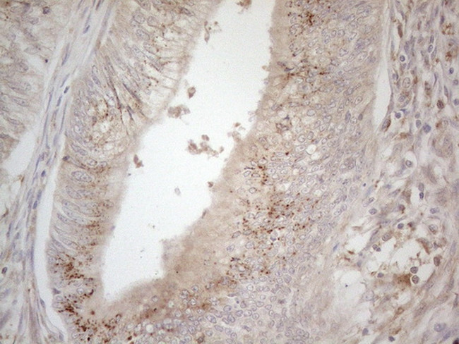 TNFRSF10B Antibody in Immunohistochemistry (Paraffin) (IHC (P))