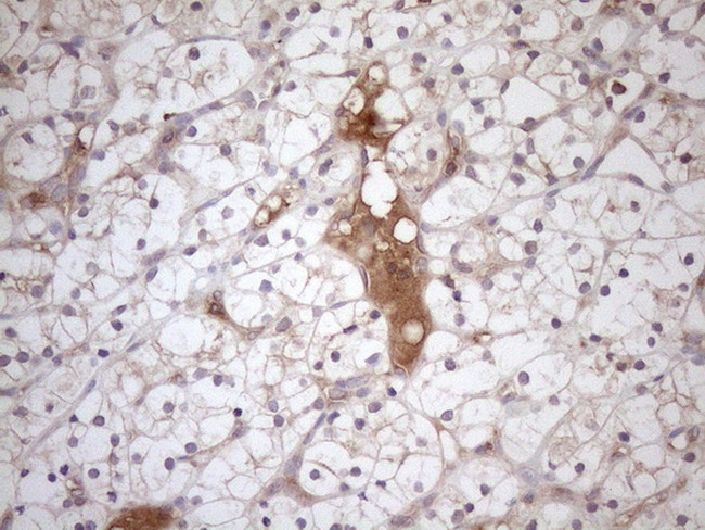 TNFRSF10B Antibody in Immunohistochemistry (Paraffin) (IHC (P))