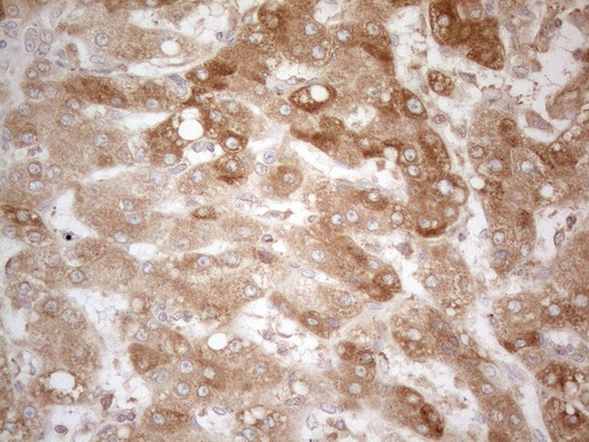 TNFRSF10B Antibody in Immunohistochemistry (Paraffin) (IHC (P))