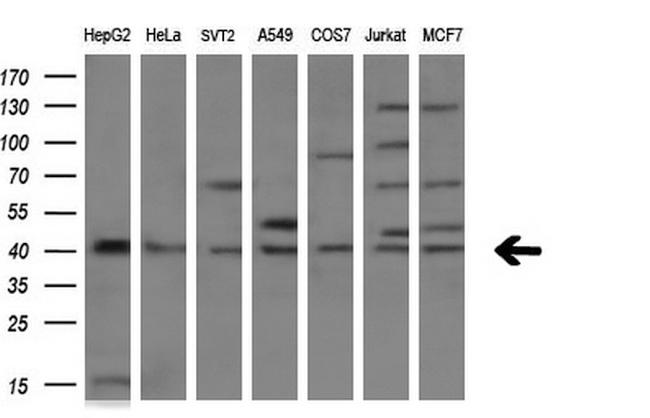 TNFRSF10B Antibody in Western Blot (WB)