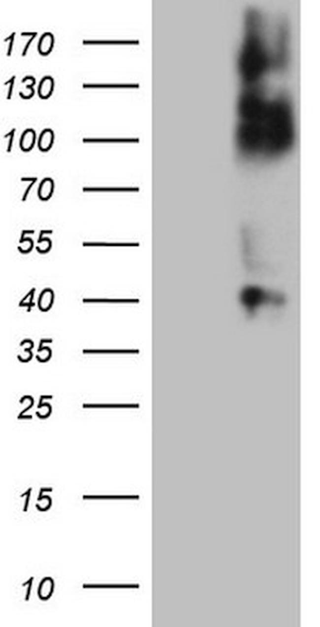 TNFRSF14 Antibody in Western Blot (WB)