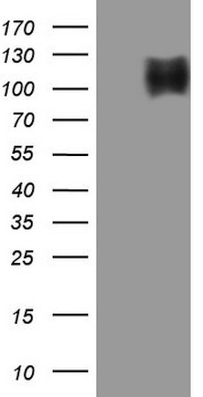 TNFRSF14 Antibody in Western Blot (WB)