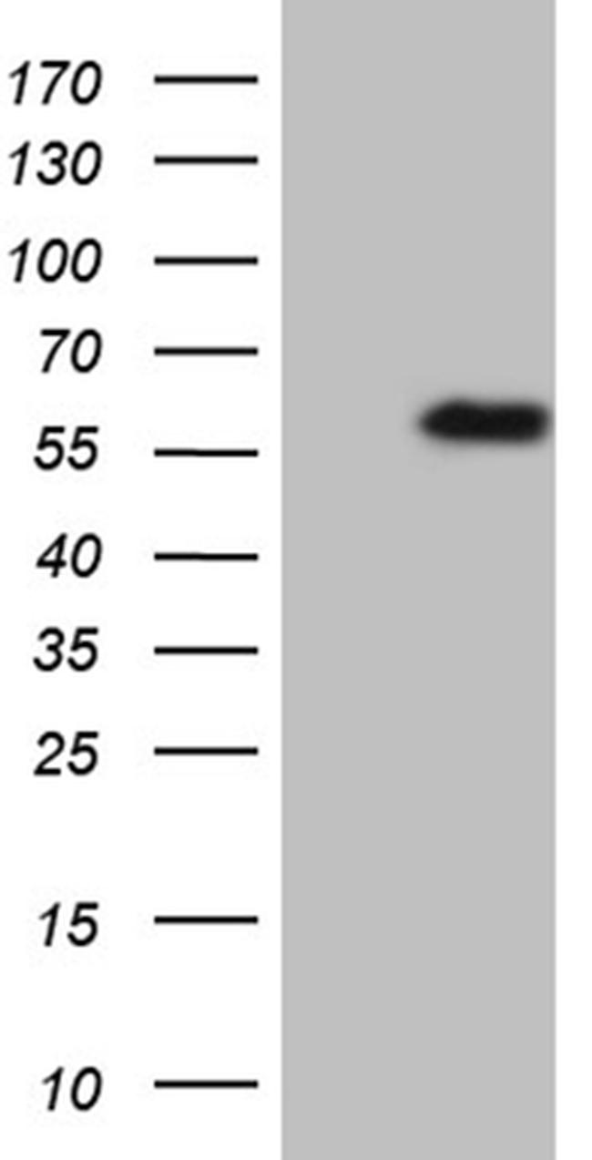 TNFRSF19 Antibody in Western Blot (WB)