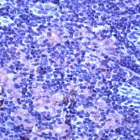 TNFR2 Antibody in Immunohistochemistry (Paraffin) (IHC (P))