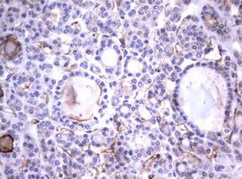 TNFRSF8 Antibody in Immunohistochemistry (Paraffin) (IHC (P))