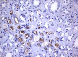 TNFRSF8 Antibody in Immunohistochemistry (Paraffin) (IHC (P))