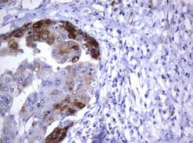 TNFRSF8 Antibody in Immunohistochemistry (Paraffin) (IHC (P))