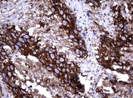 TNFRSF8 Antibody in Immunohistochemistry (Paraffin) (IHC (P))