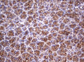 TNFRSF8 Antibody in Immunohistochemistry (Paraffin) (IHC (P))