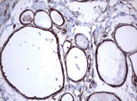 TNFRSF8 Antibody in Immunohistochemistry (Paraffin) (IHC (P))