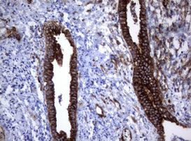 TNFRSF8 Antibody in Immunohistochemistry (Paraffin) (IHC (P))