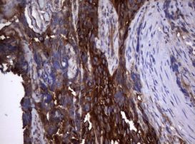 TNFRSF8 Antibody in Immunohistochemistry (Paraffin) (IHC (P))