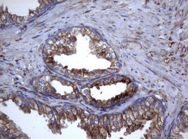 TNFRSF8 Antibody in Immunohistochemistry (Paraffin) (IHC (P))