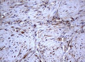 TNFRSF8 Antibody in Immunohistochemistry (Paraffin) (IHC (P))