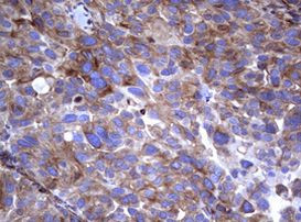 TNFRSF8 Antibody in Immunohistochemistry (Paraffin) (IHC (P))