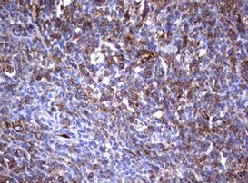 TNFRSF8 Antibody in Immunohistochemistry (Paraffin) (IHC (P))