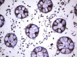 TNFRSF8 Antibody in Immunohistochemistry (Paraffin) (IHC (P))