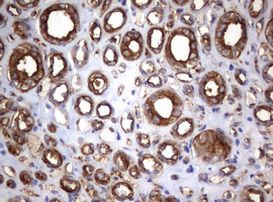 TNFRSF8 Antibody in Immunohistochemistry (Paraffin) (IHC (P))