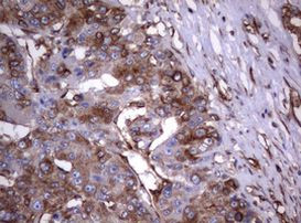 TNFRSF8 Antibody in Immunohistochemistry (Paraffin) (IHC (P))