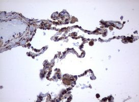 TNFRSF8 Antibody in Immunohistochemistry (Paraffin) (IHC (P))