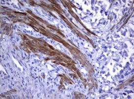 TNFRSF8 Antibody in Immunohistochemistry (Paraffin) (IHC (P))