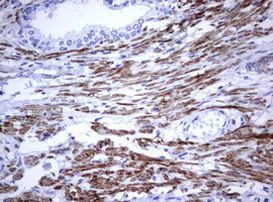 TNFRSF8 Antibody in Immunohistochemistry (Paraffin) (IHC (P))