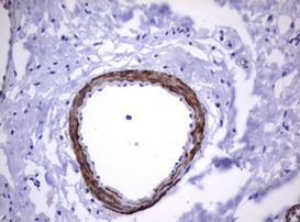 TNFRSF8 Antibody in Immunohistochemistry (Paraffin) (IHC (P))