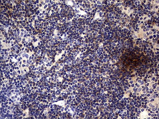 TNFRSF8 Antibody in Immunohistochemistry (Paraffin) (IHC (P))