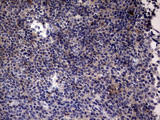 TNFRSF8 Antibody in Immunohistochemistry (Paraffin) (IHC (P))