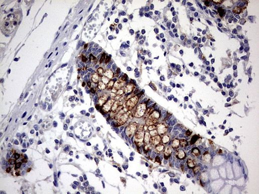 TNFRSF8 Antibody in Immunohistochemistry (Paraffin) (IHC (P))