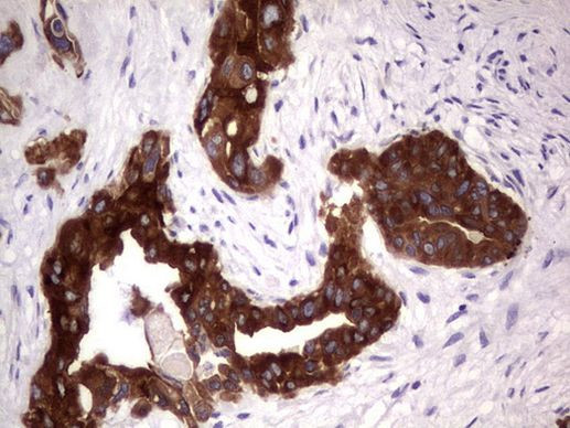 TNFRSF8 Antibody in Immunohistochemistry (Paraffin) (IHC (P))