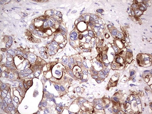 TNFRSF8 Antibody in Immunohistochemistry (Paraffin) (IHC (P))