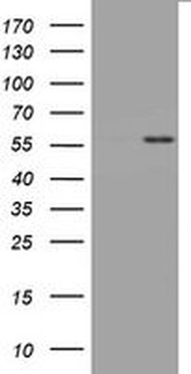 TNFRSF8 Antibody in Western Blot (WB)