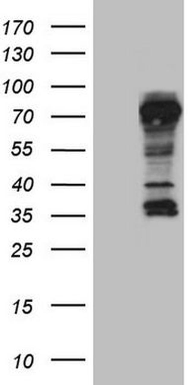 TNFRSF8 Antibody in Western Blot (WB)